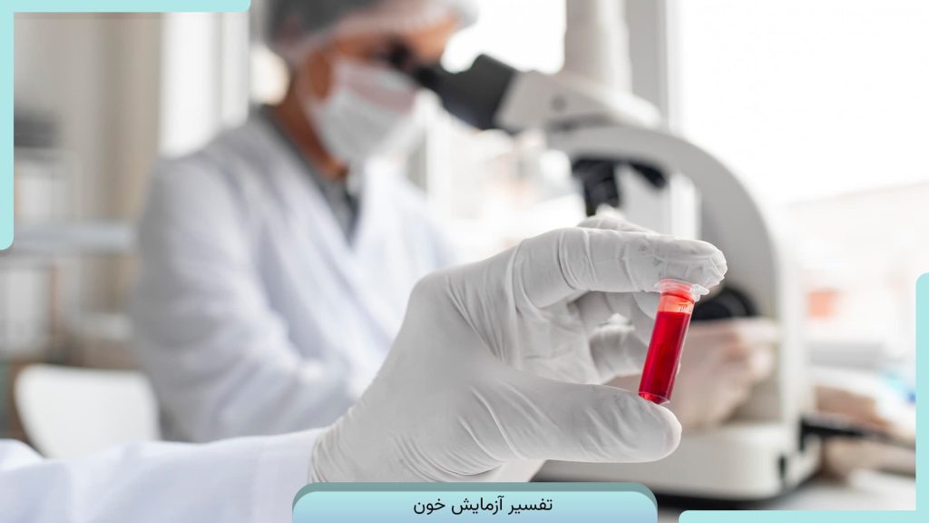 راهنمای جامع تحلیل و تفسیر آزمایش خون + توضیح علامت‌ها در جواب آزمایش